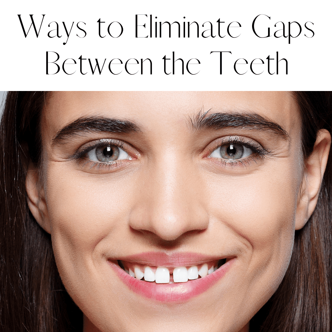 Ways to Eliminate Gaps Between Teeth